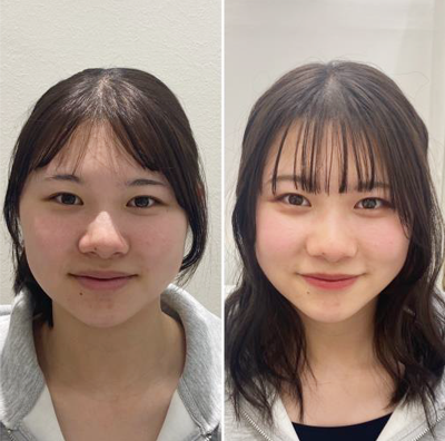 ビフォーアフター画像